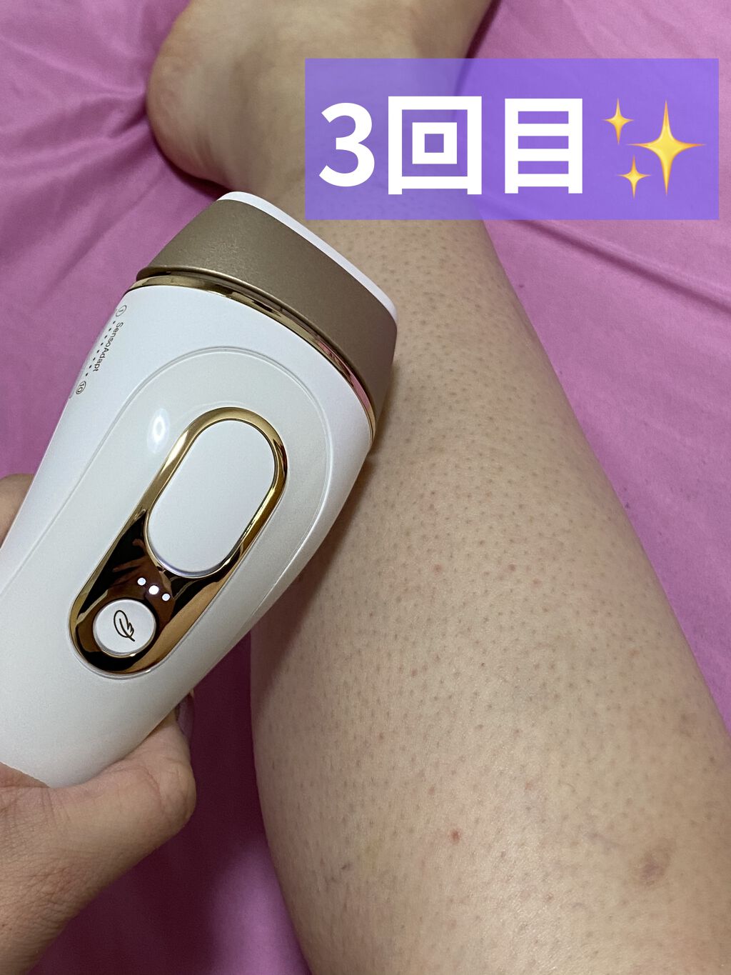 BRAUN Silk-expert 3 フラッシュ脱毛器 BRAUN Silk-expert 3 脱毛器 自宅用フラッシュ美容器 ブラウン