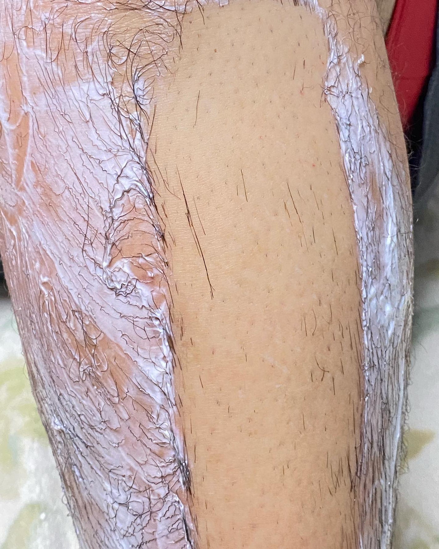 パイナップル豆乳除毛クリーム/鈴木ハーブ研究所/除毛クリームを使ったクチコミ(8枚目)