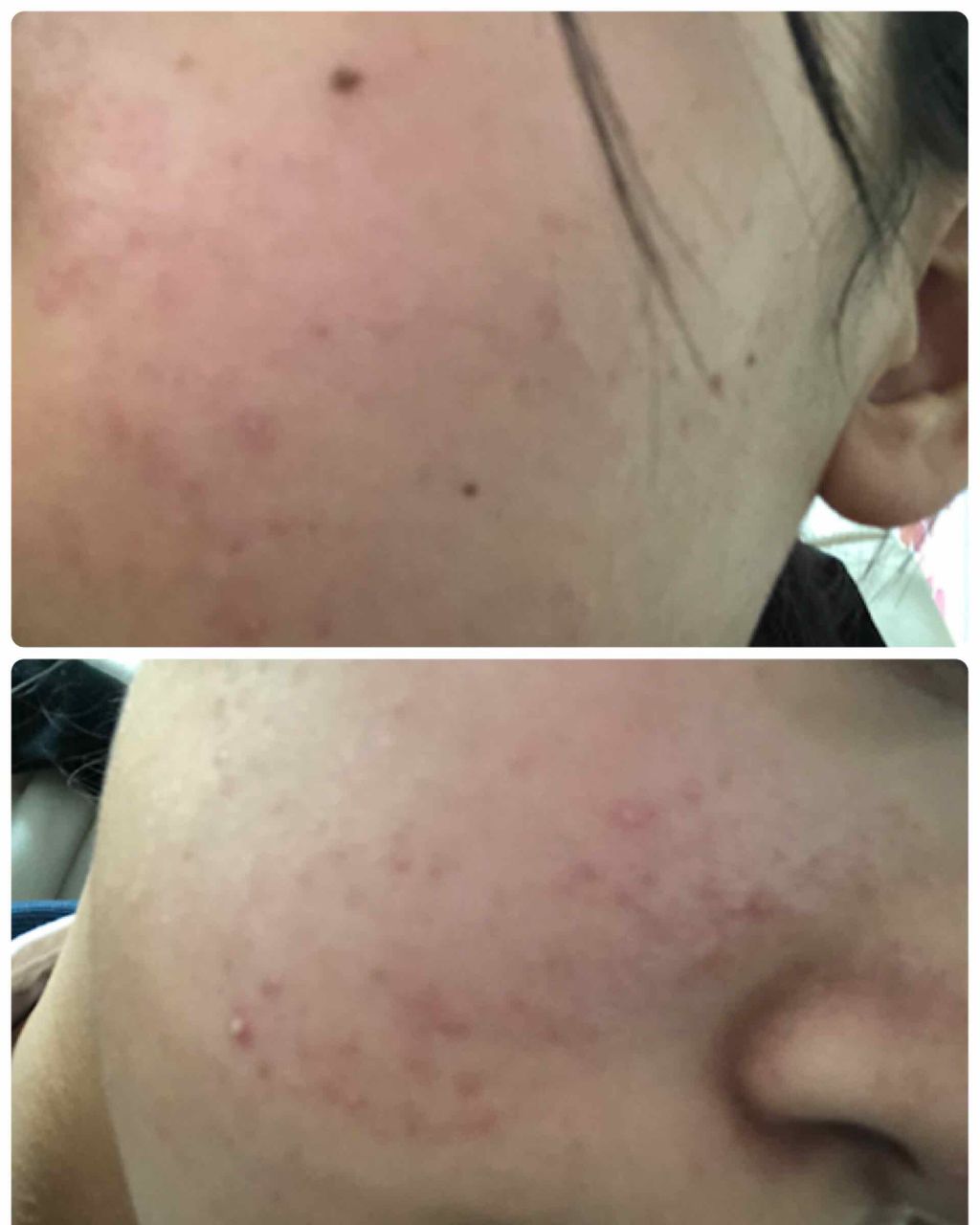 ビキ子 on LIPS 「⇐本当に観覧注意です。ご注意ください😱不快な思いをさせてしまい..」(2枚目)