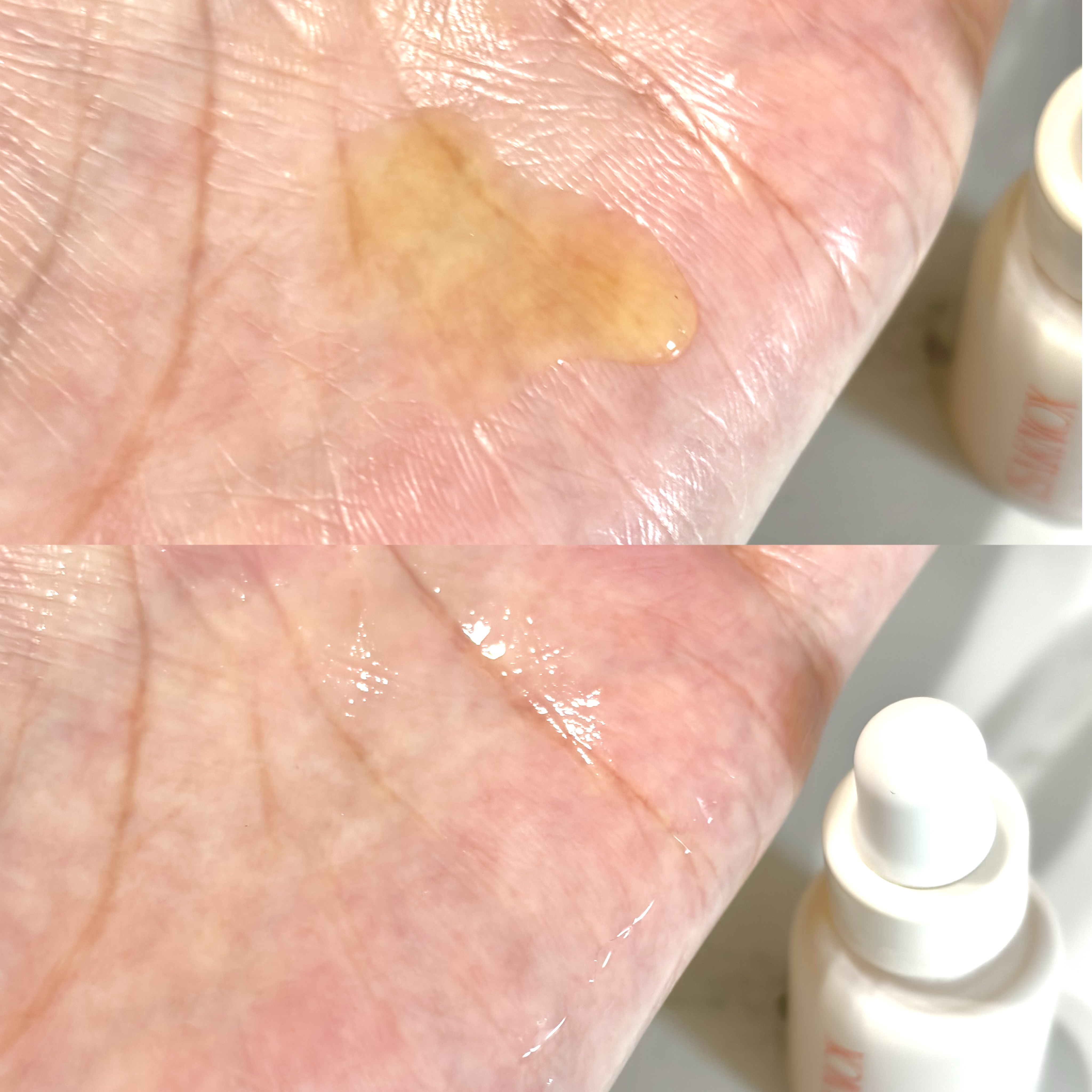 ビタマックスアンプル/イザノックス/美容液を使ったクチコミ（3枚目）