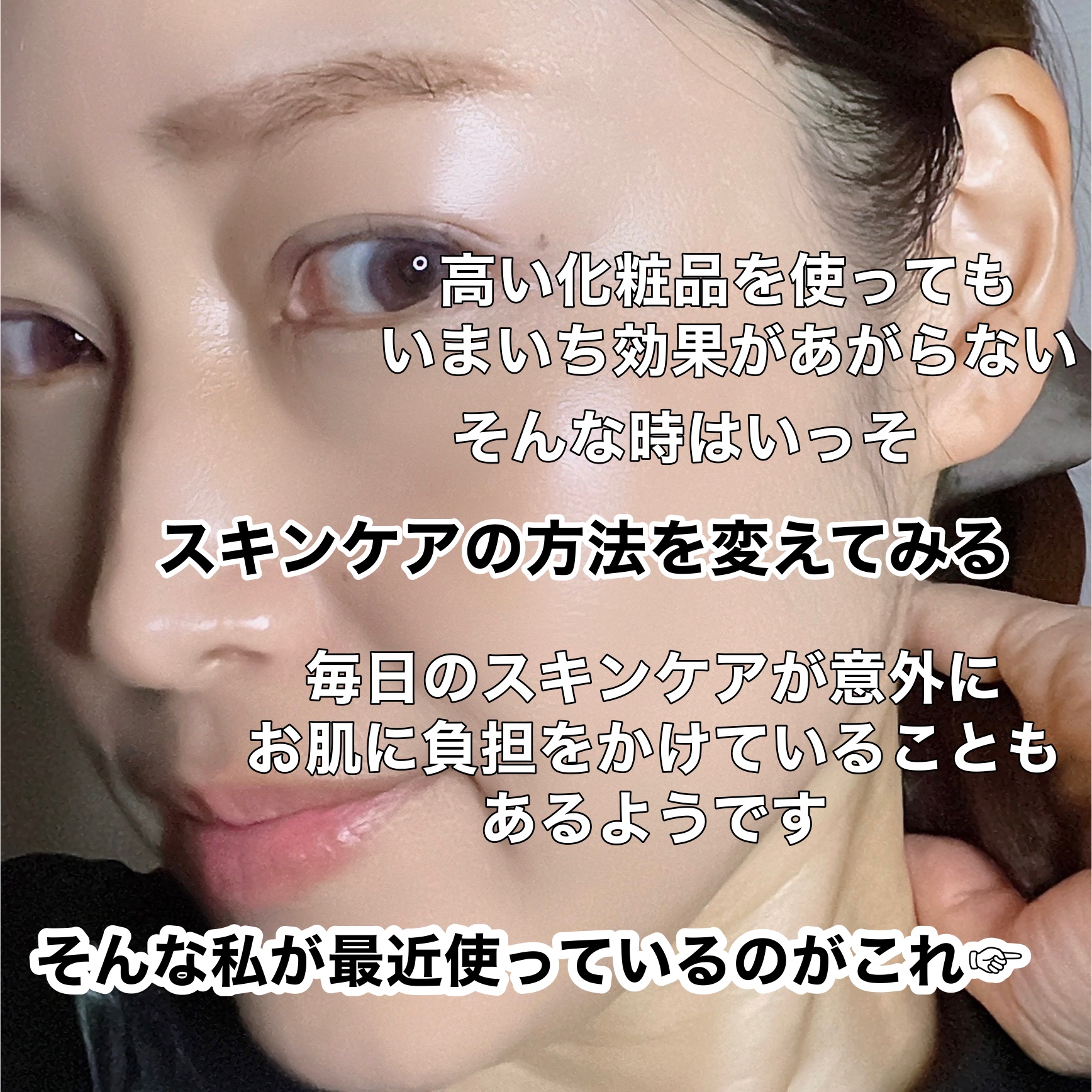 トラネキサム酸　250mg/東和薬品/その他を使ったクチコミ（2枚目）