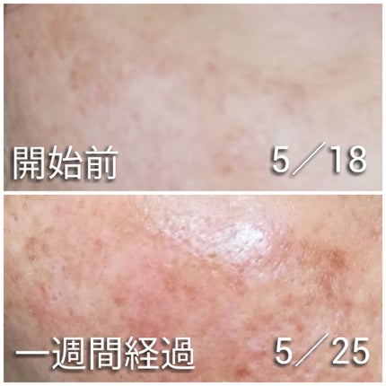 URGLAM SILICONE TIP B(シリコンチップB)/U R GLAM/その他化粧小物を使ったクチコミ(2枚目)