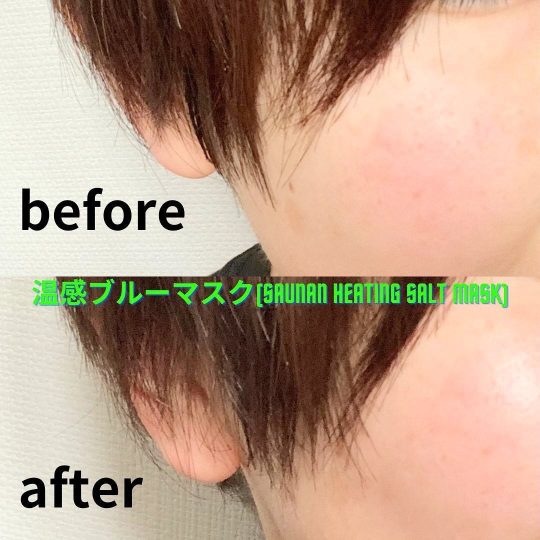 温感ブルーマスク/Torhop/洗い流すパック・マスクを使ったクチコミ(4枚目)