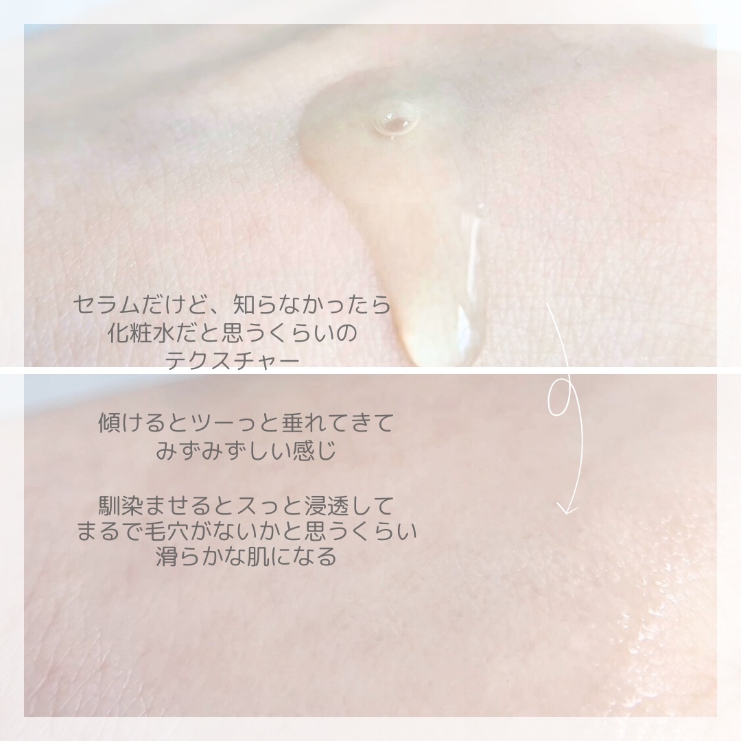 ナイアシンアミドブレミッシュケアセラム/ONE THING/美容液を使ったクチコミ（3枚目）