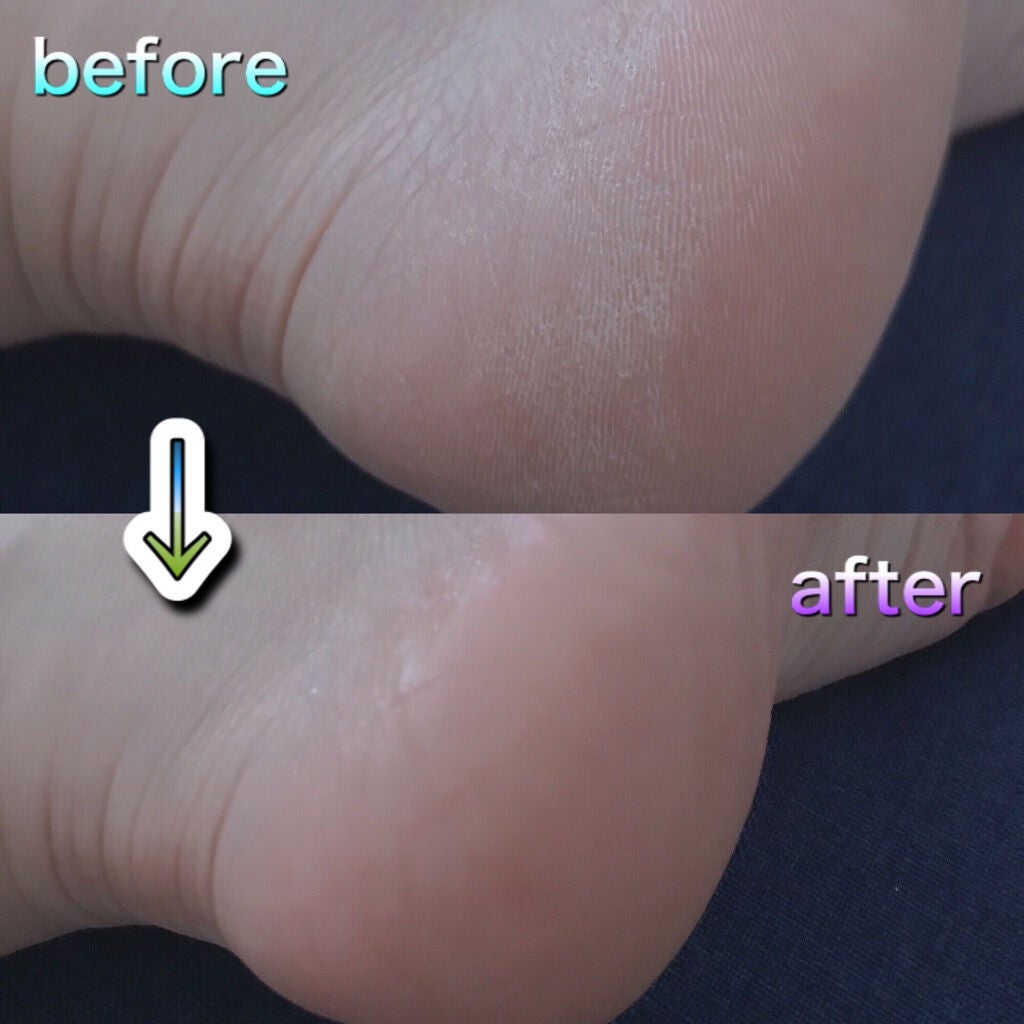 ノルウェーフォーミュラ インテンスリペア リッチバーム/Neutrogena/フェイスバームを使ったクチコミ(2枚目)