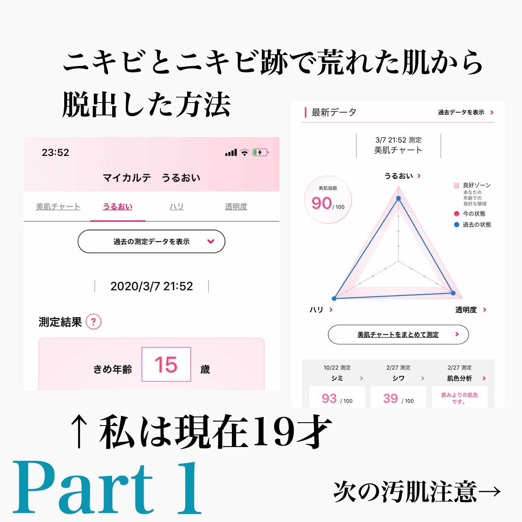 チョコラBBプラス (医薬品)/チョコラBB/その他を使ったクチコミ（1枚目）