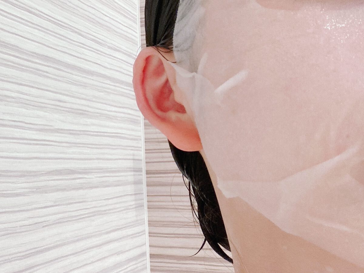 スキントラブルケア マスク/アルージェ/シートマスク・パックを使ったクチコミ(6枚目)