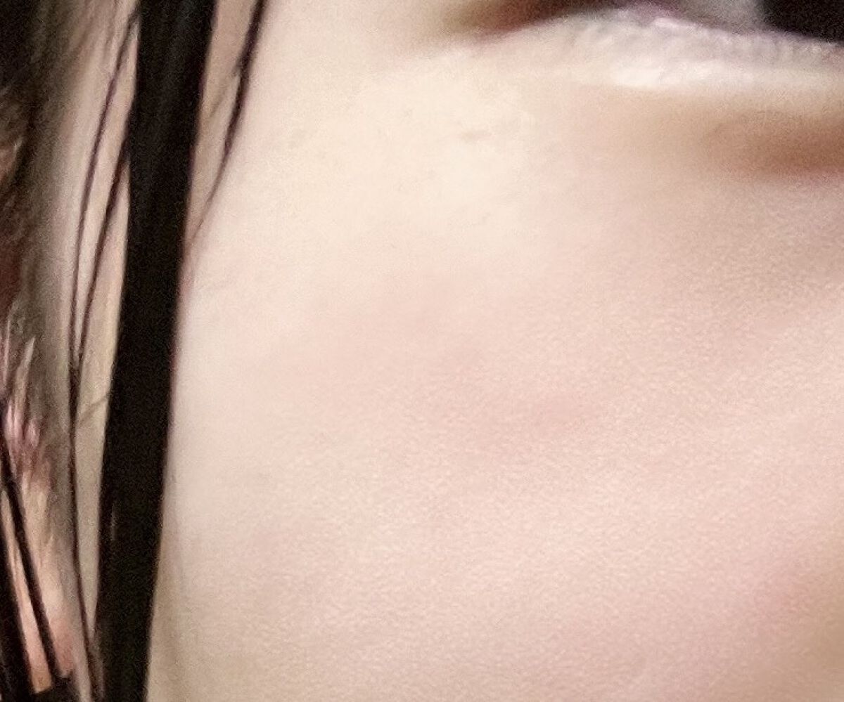 ペアアクネクリームW(医薬品)/ペア/その他を使ったクチコミ（3枚目）