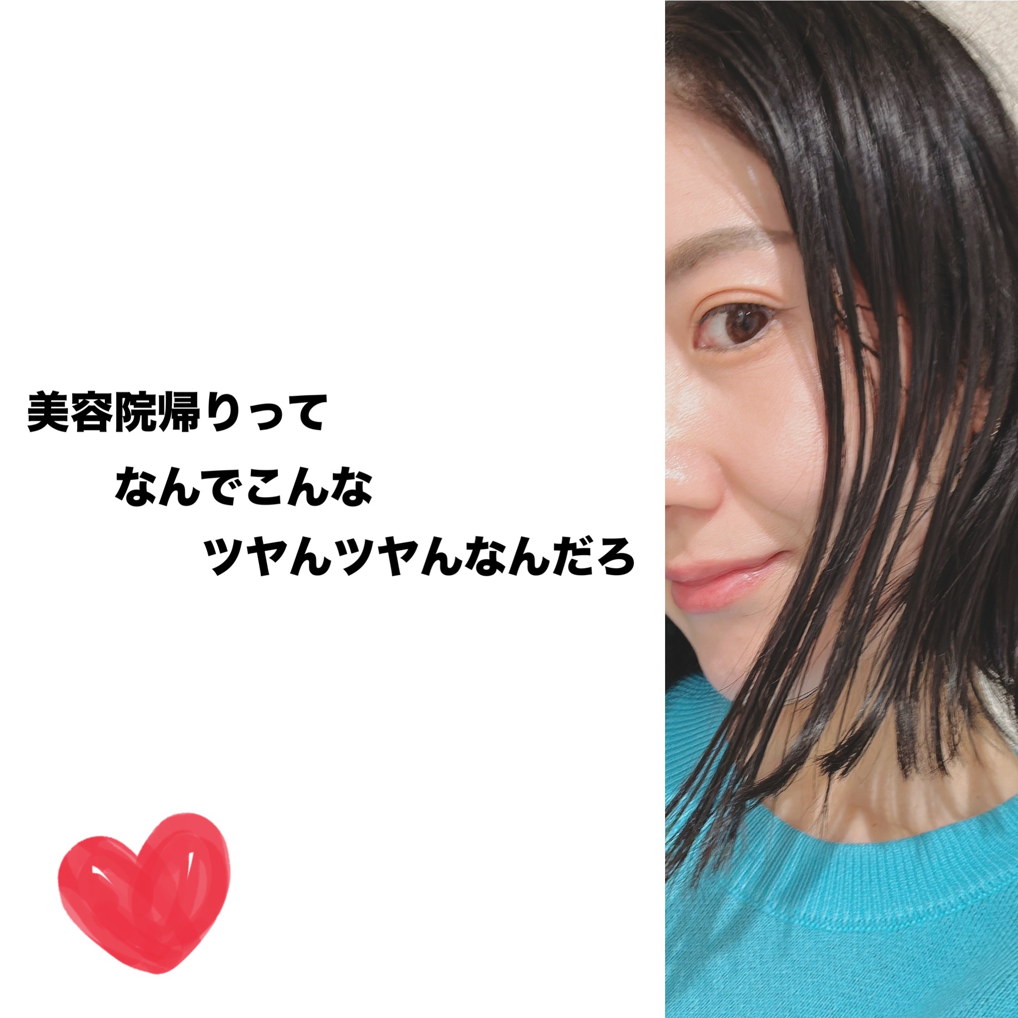 ラディアント タッチ/YVES SAINT LAURENT BEAUTE/リキッドコンシーラーを使ったクチコミ（2枚目）