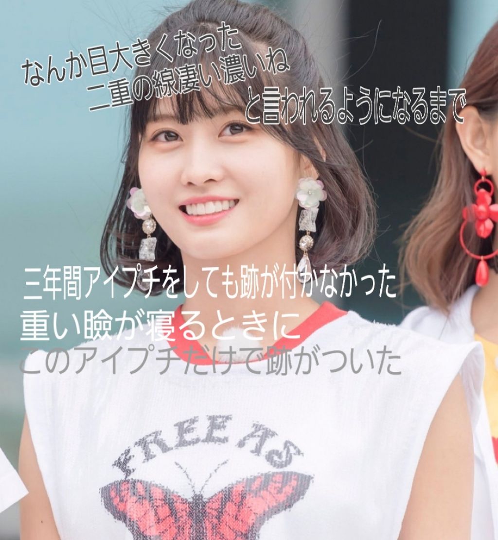 シングルアイテープ/Automatic Beauty/二重まぶた用アイテムを使ったクチコミ(1枚目)