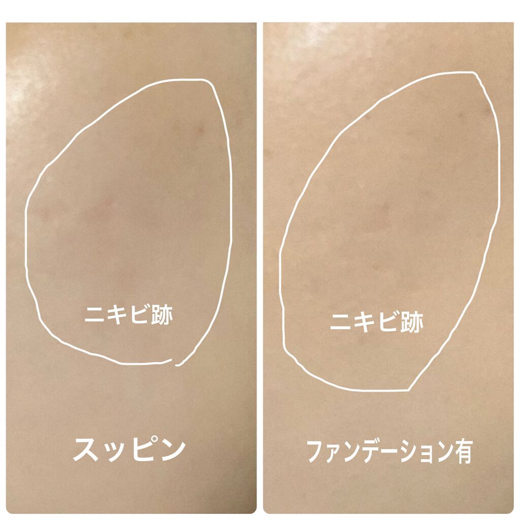ピンクティーツリーカバークッション/APLIN/クッションファンデーションを使ったクチコミ(4枚目)