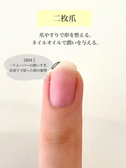 ビューティーチャージ ナイトスペリア/アトリックス/ハンドクリームを使ったクチコミ(4枚目)