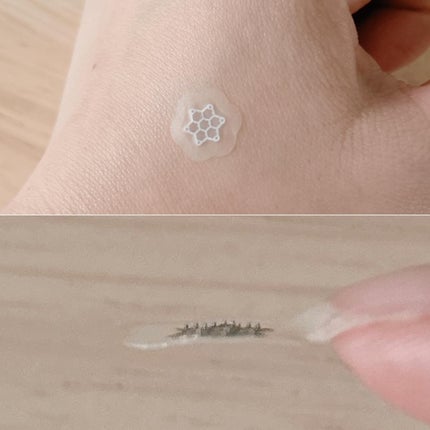 ACマグネシウムパッチ ミニ/スノーツープラス/にきびパッチを使ったクチコミ(3枚目)