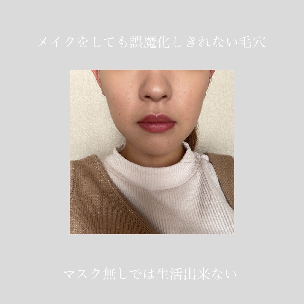 美白化粧水 VC/ちふれ/化粧水を使ったクチコミ（3枚目）