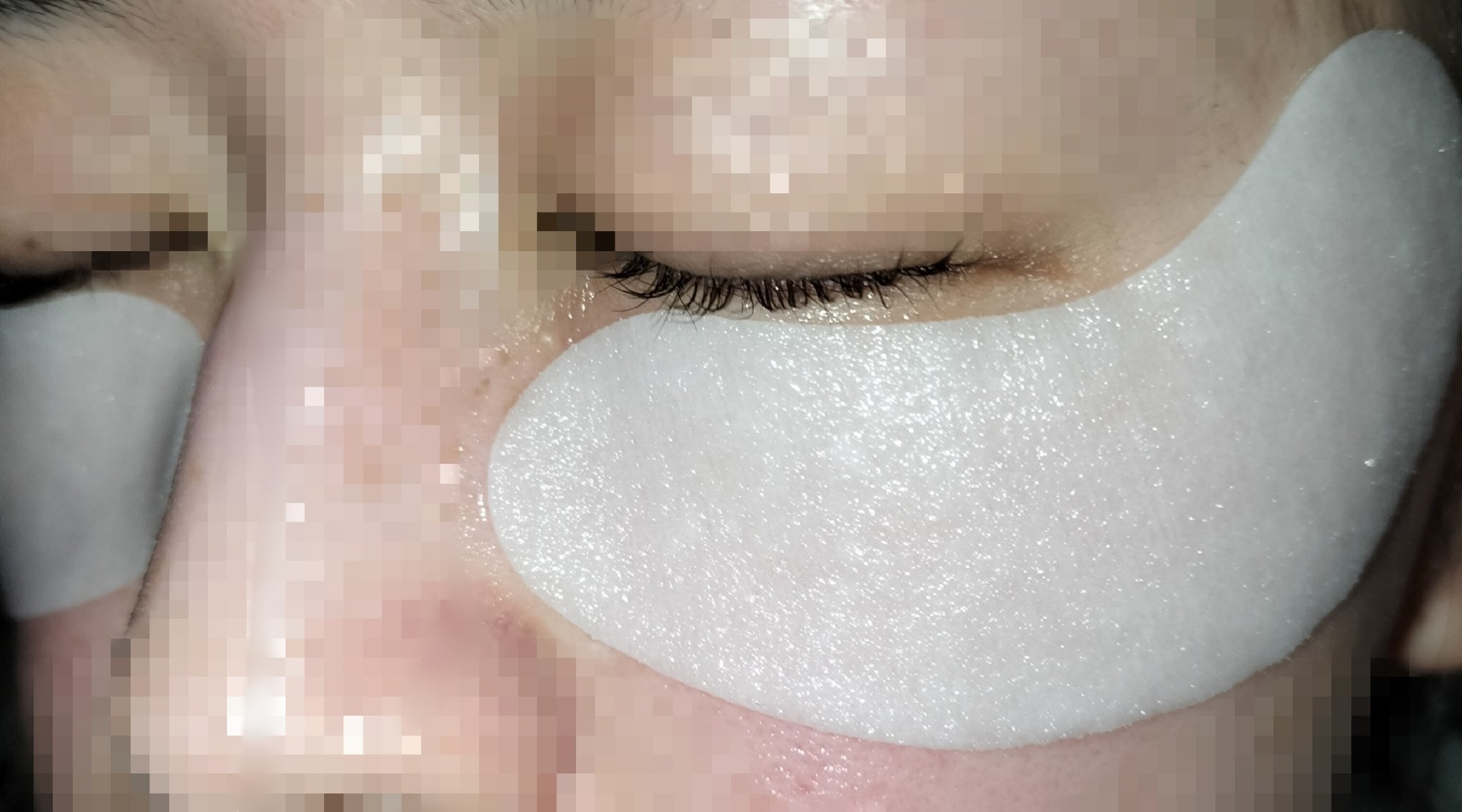 ダーマレーザー アイシート スーパーVCR/クオリティファースト/アイケア・アイクリームを使ったクチコミ（2枚目）