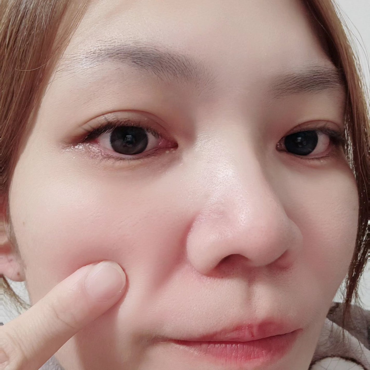 RJスペシャルコンク/アピセラピーコスメティクス/美容液を使ったクチコミ(4枚目)