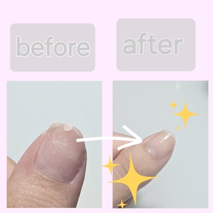 デイケアオイル/Dr.Nail/ネイルオイル・トリートメントを使ったクチコミ(4枚目)