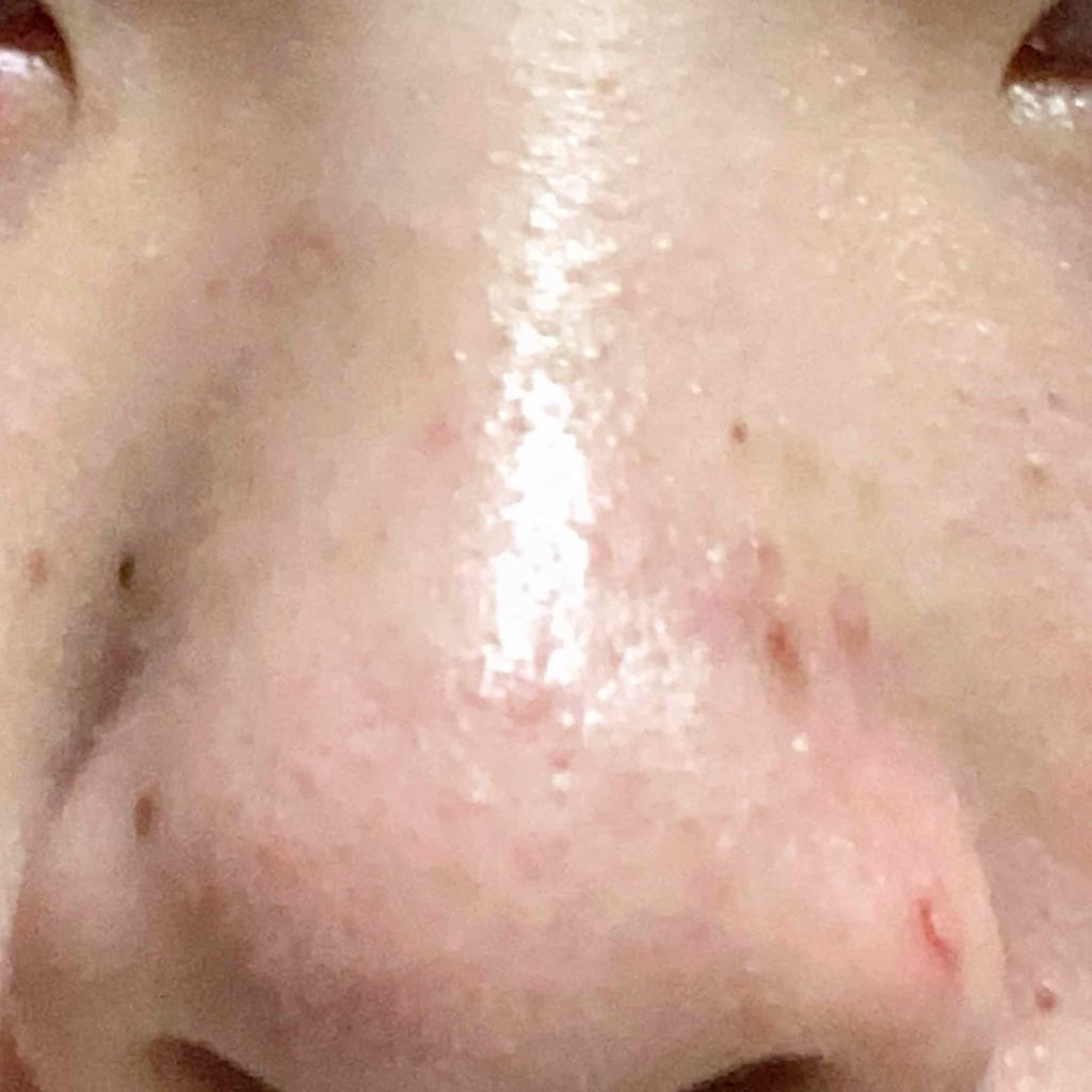 ハトムギ化粧水(ナチュリエ スキンコンディショナー R )/ナチュリエ/化粧水を使ったクチコミ(2枚目)