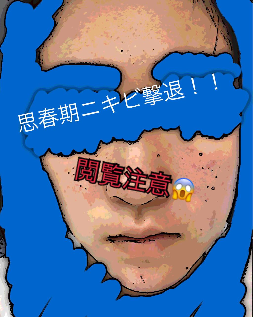 A アクネフォーム/NOV/洗顔フォームを使ったクチコミ(1枚目)