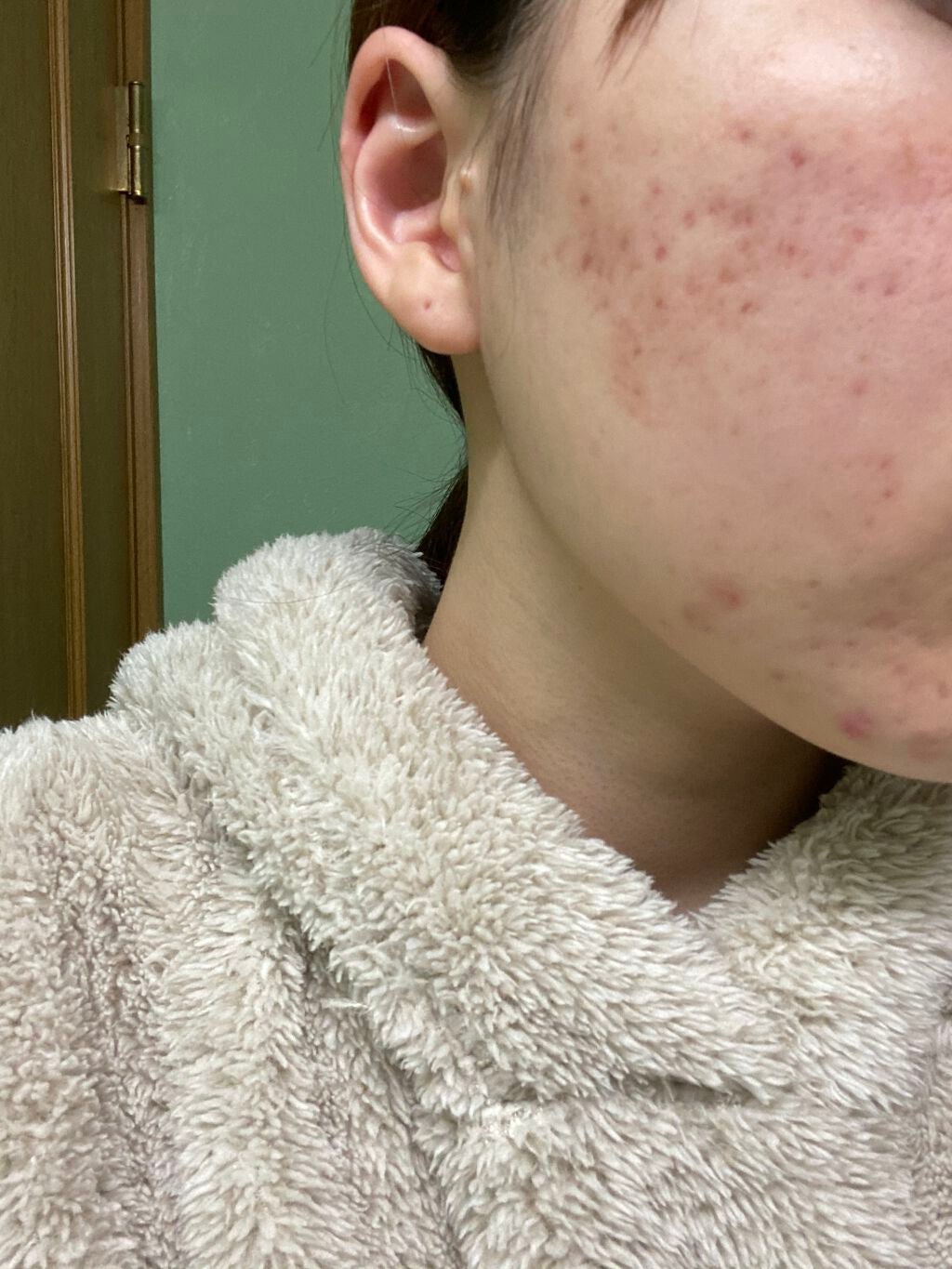 チョコラBBプラス (医薬品)/チョコラBB/その他を使ったクチコミ(2枚目)