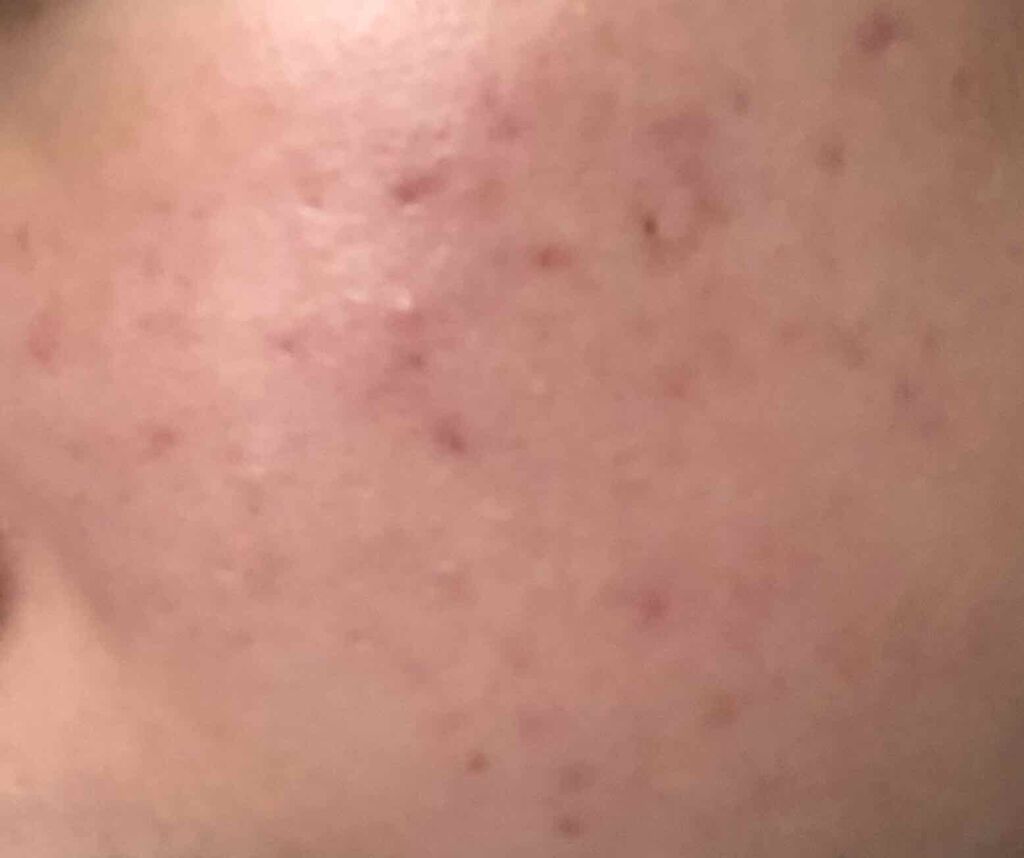 DHC マルチビタミン/DHC/美容サプリメントを使ったクチコミ(2枚目)