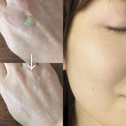 アゼライン酸15 インテンスカーミングセラム/Anua/美容液を使ったクチコミ(2枚目)