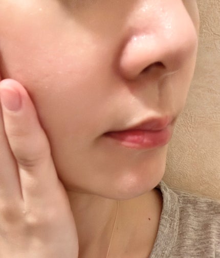 オルビスユー エッセンスローション /オルビス/化粧水を使ったクチコミ(5枚目)