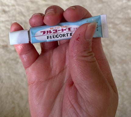 フルコートF(医薬品)/田辺三菱製薬/その他を使ったクチコミ(1枚目)