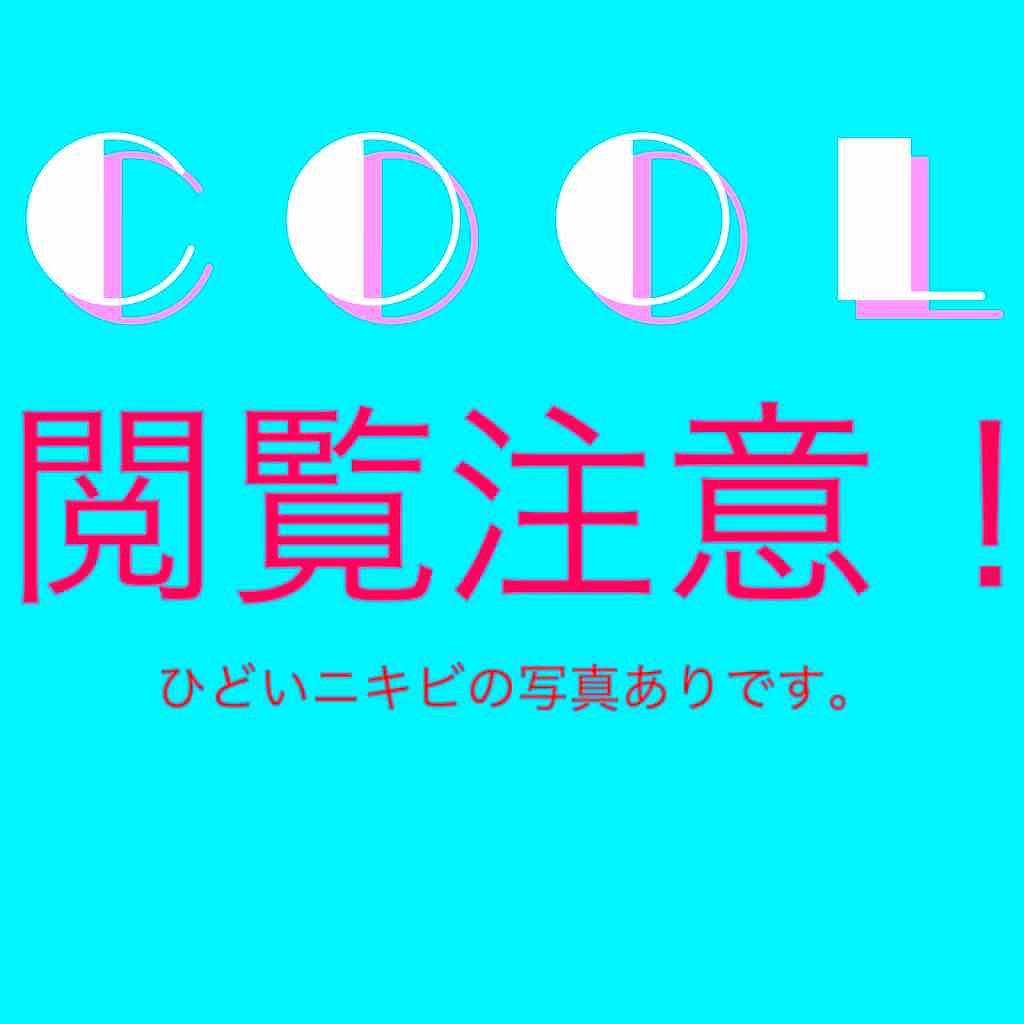 ノブ A アクネソープ/NOV/洗顔石鹸を使ったクチコミ(1枚目)