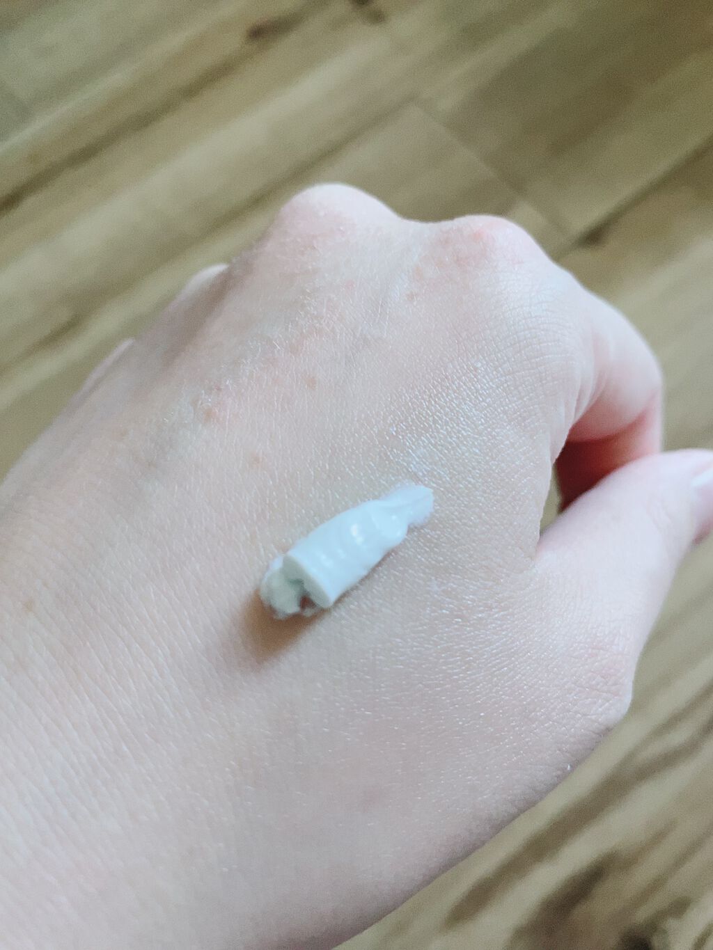 シカルファットプラス リペアクリーム/アベンヌ/フェイスクリームを使ったクチコミ(4枚目)