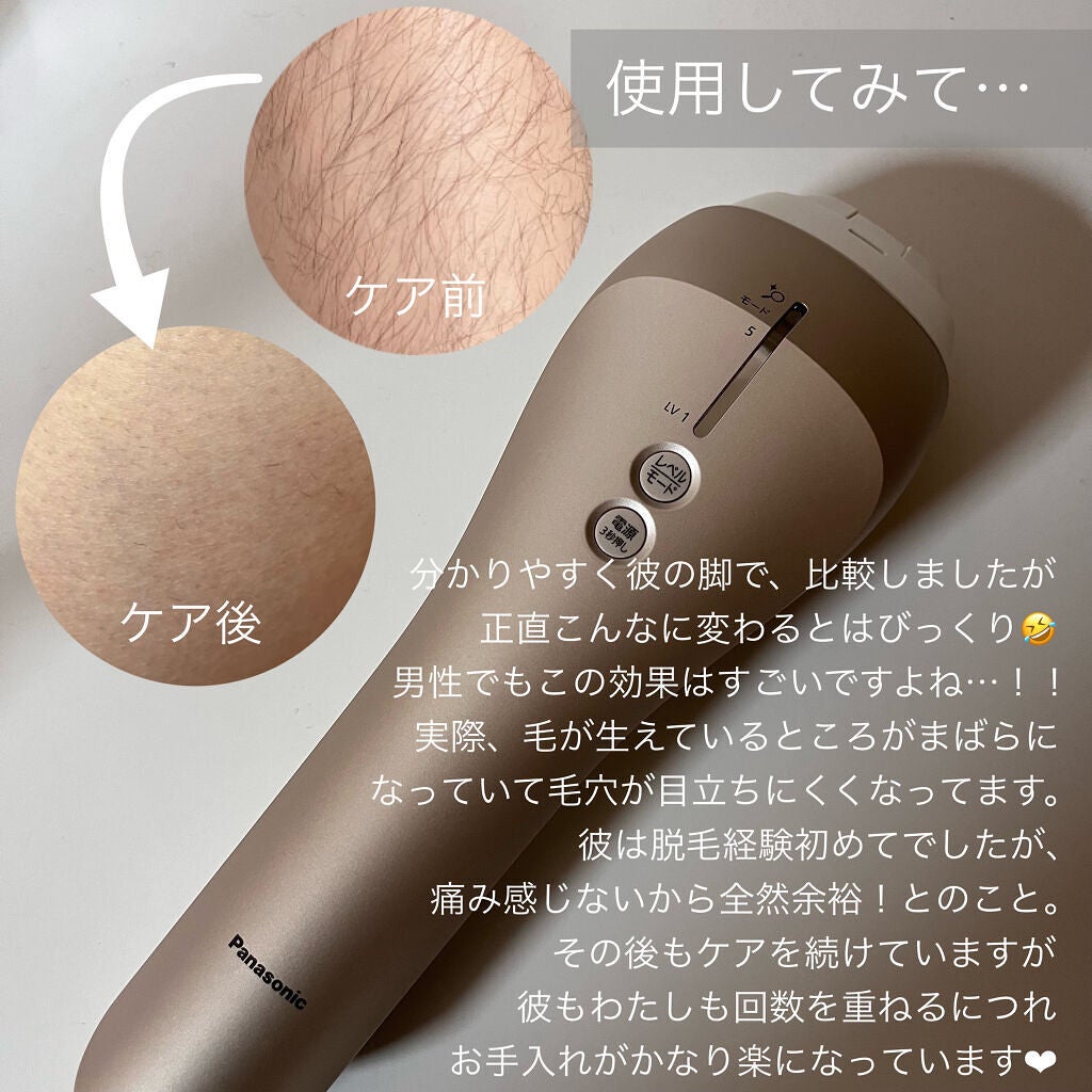 光美容器 光エステ<ボディ&フェイス用> ES-WP98/Panasonic/家庭用脱毛器を使ったクチコミ(6枚目)