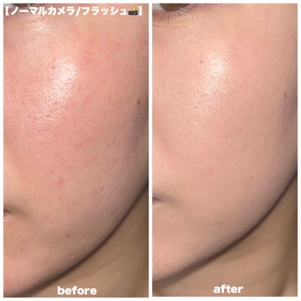 スキンバリアグロウカバークッション/Ongredients/クッションファンデーションを使ったクチコミ(4枚目)