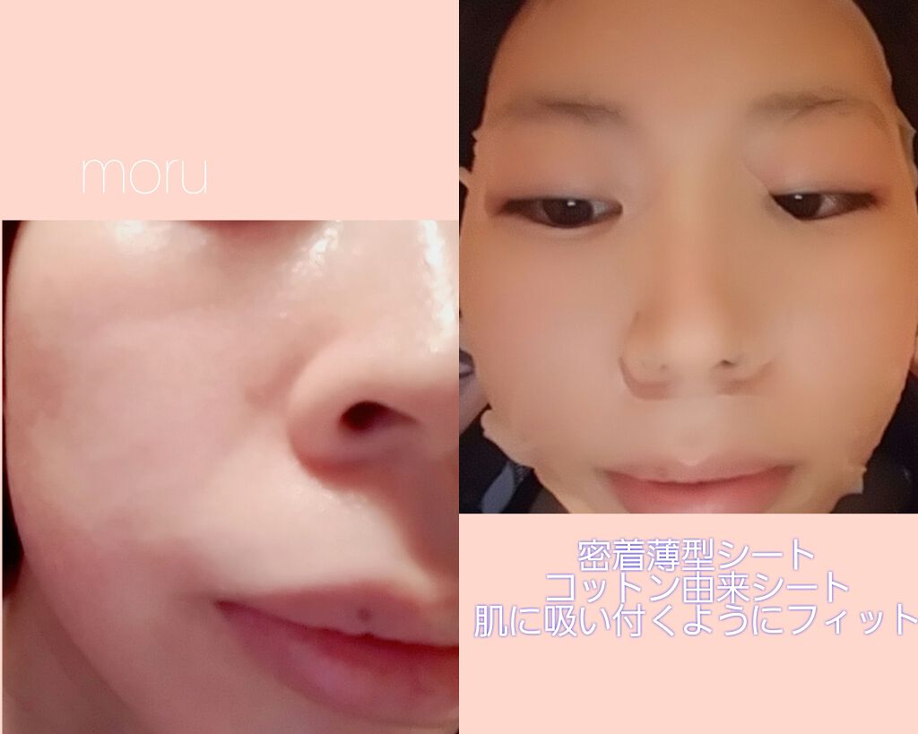 モイストファーマ シートマスク/unlabel/シートマスク・パックを使ったクチコミ(2枚目)