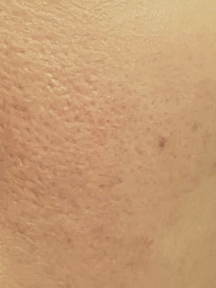 ポアカバー/ポイントマジックPRO/化粧下地を使ったクチコミ(4枚目)