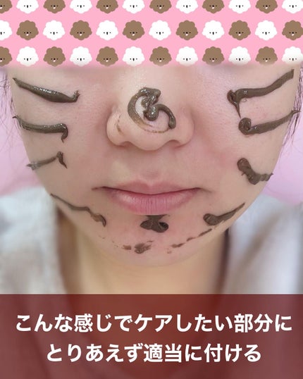 ごんす@YouTube始めました on LIPS 「《ツルンッとむきたて卵肌に❤︎》毛穴やニキビが気になる刺激の強..」(3枚目)