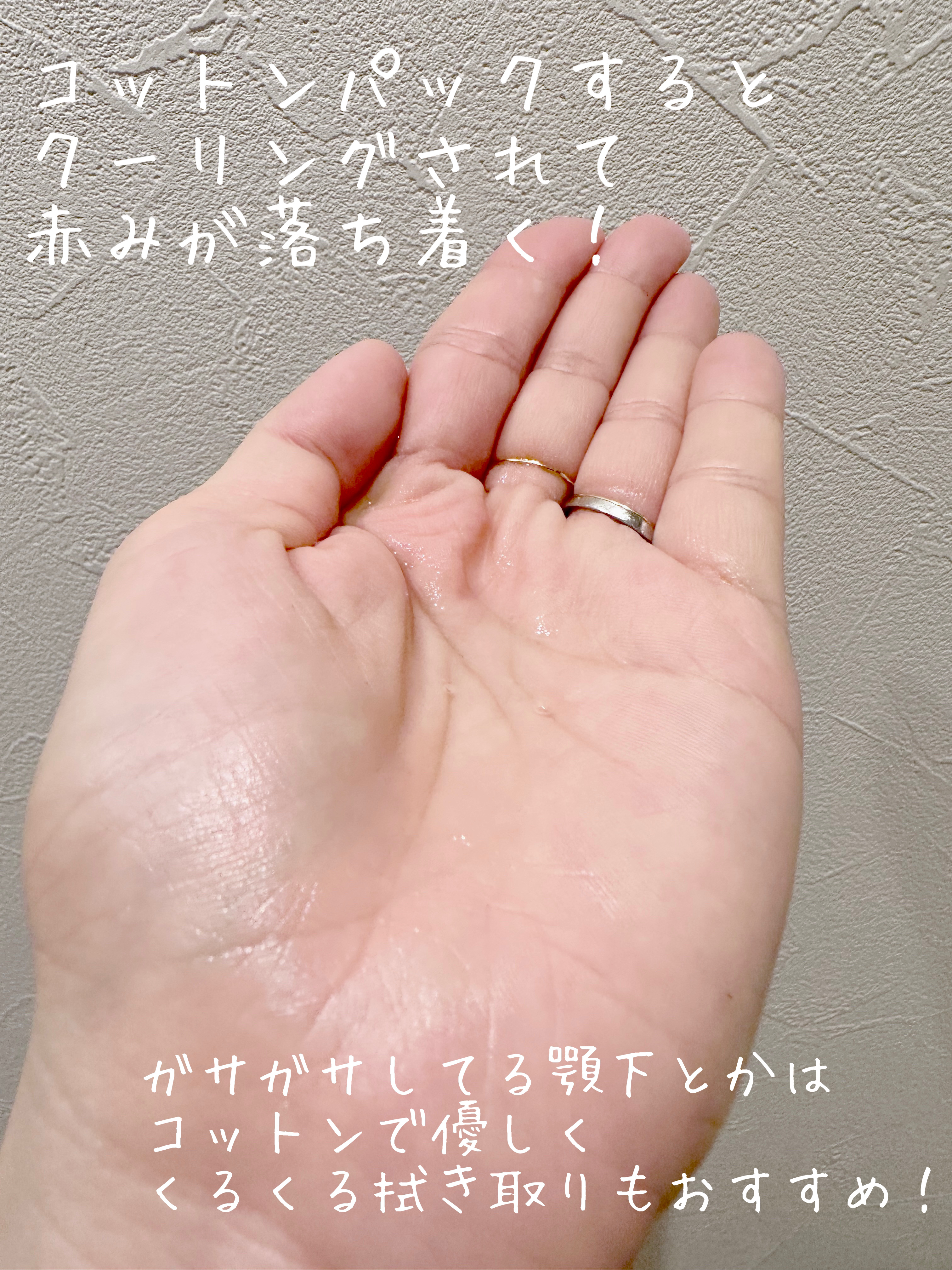 リアルドクダミスージングエッセンス/NEOGEN/化粧水を使ったクチコミ（3枚目）