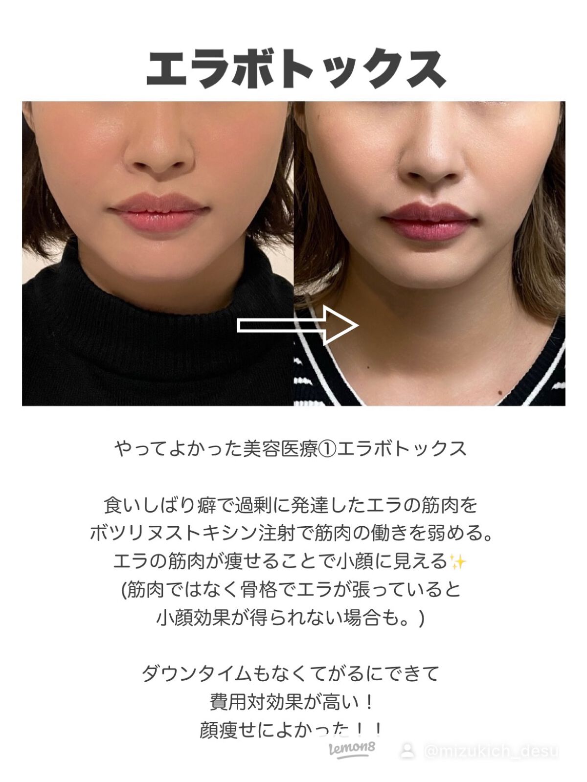 を使ったクチコミ（2枚目）