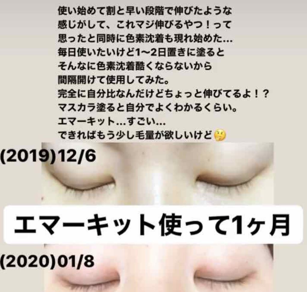EMAKED(エマーキット)/水橋保寿堂製薬/まつげ美容液を使ったクチコミ(2枚目)