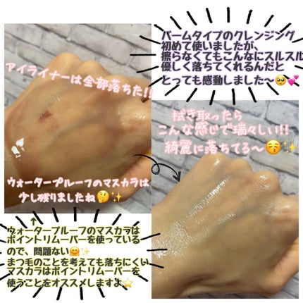 夢みるバーム 白泥リフトモイスチャー/ロゼット/クレンジングバームを使ったクチコミ(6枚目)