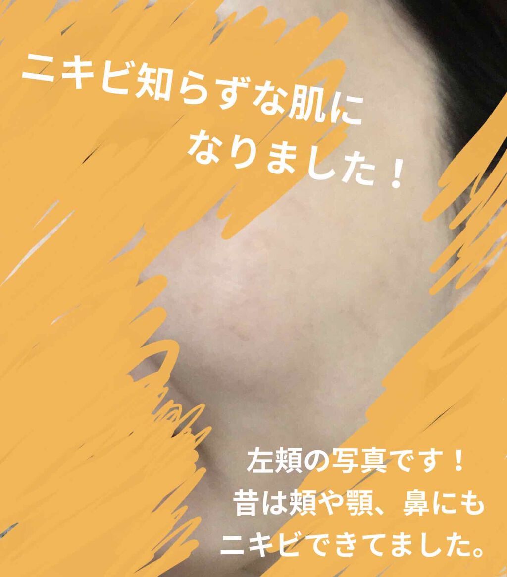 ペアアクネクリームW(医薬品)/ペア/その他を使ったクチコミ(1枚目)