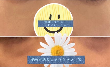 トーンパーフェクティング パレット/DECORTÉ/パレットコンシーラーを使ったクチコミ(4枚目)