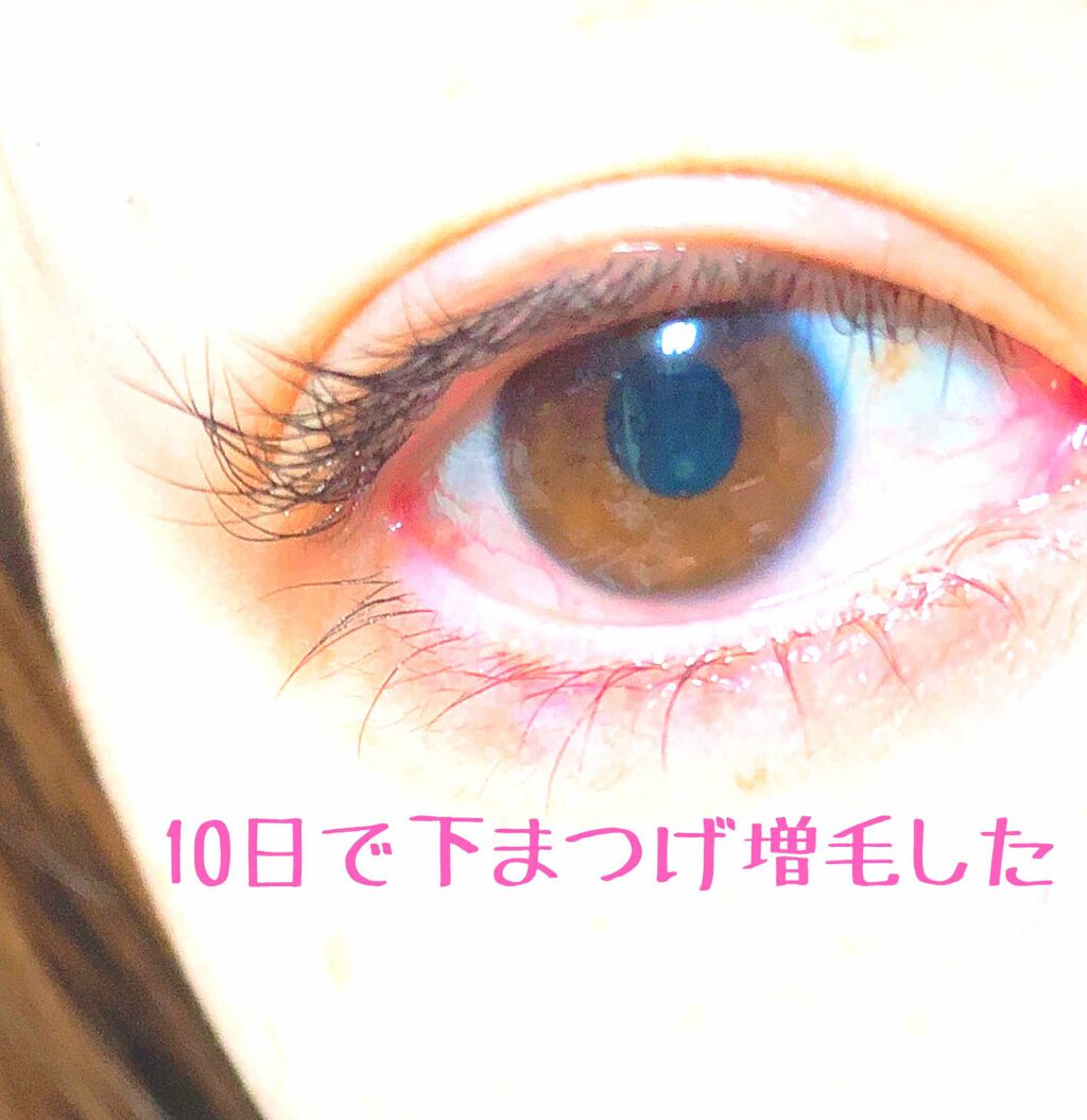 エグータム/アルマダスタイル/まつげ美容液を使ったクチコミ（1枚目）