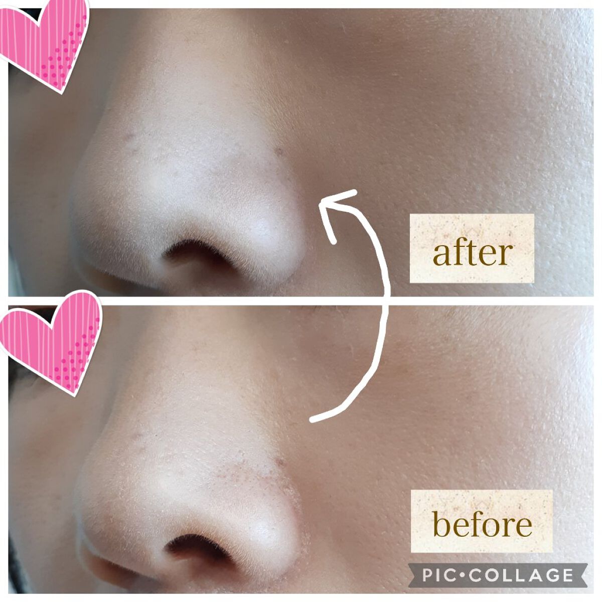 ポアレスフィクサー/プリマヴィスタ/ルースパウダーを使ったクチコミ(6枚目)