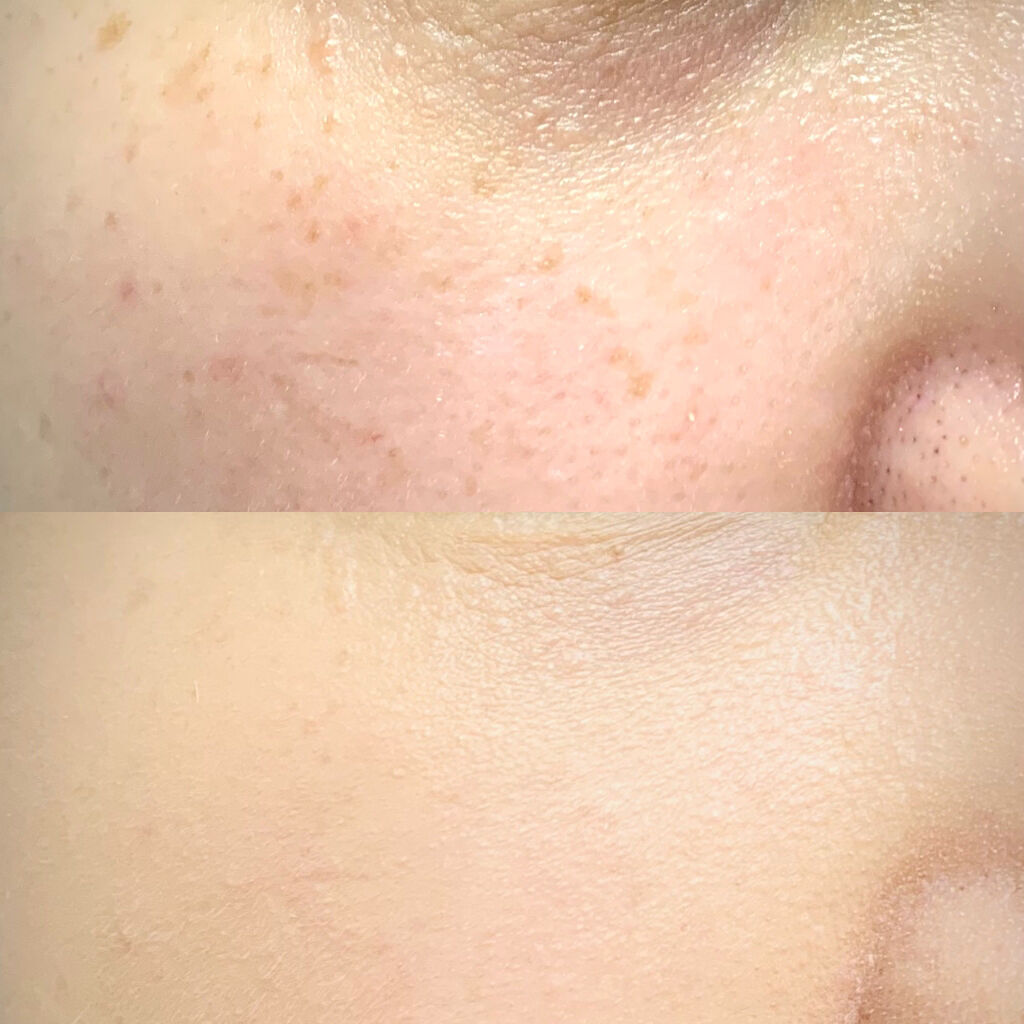 シルキーステイファンデーション/HERA/リキッドファンデーションを使ったクチコミ（3枚目）