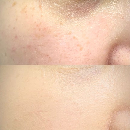 シルキーステイファンデーション/HERA/リキッドファンデーションを使ったクチコミ(3枚目)