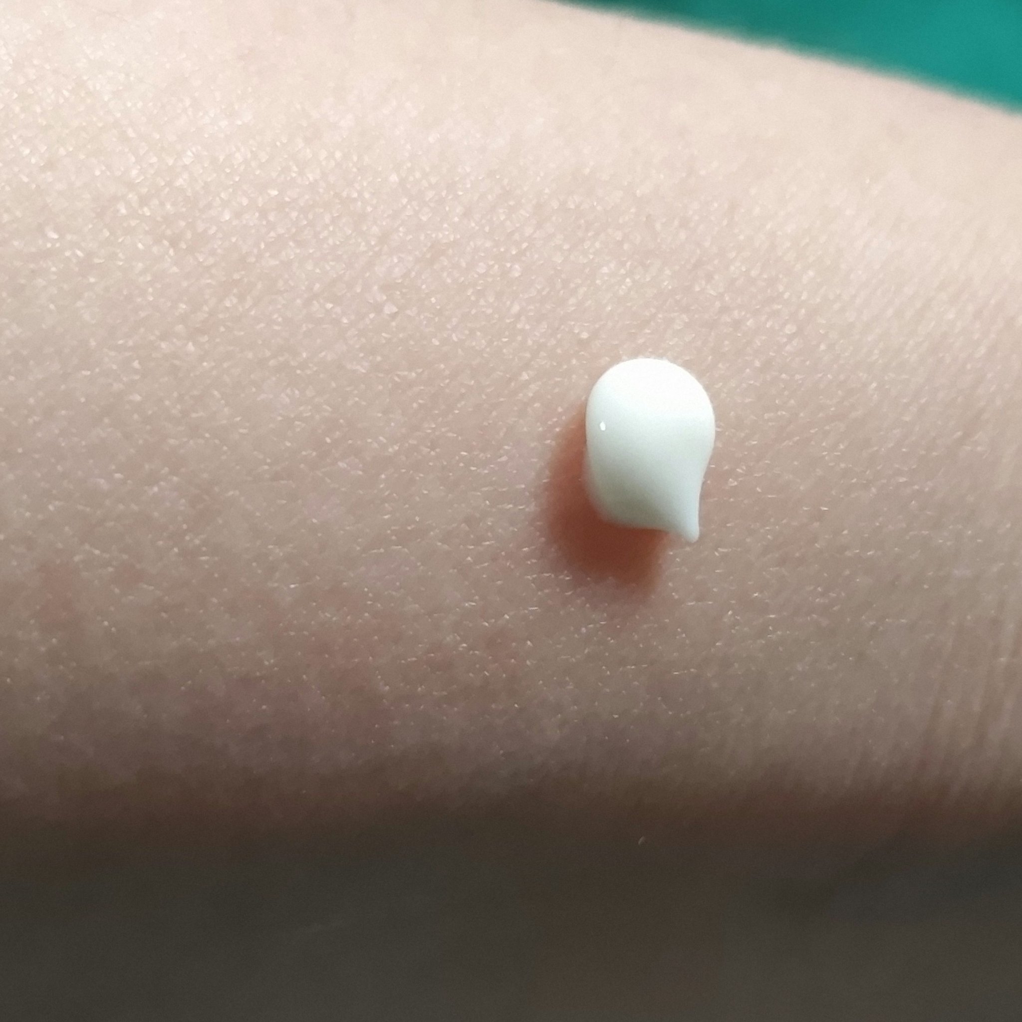 オイデルミンエッセンスローション/SHISEIDO/美容液を使ったクチコミ（2枚目）