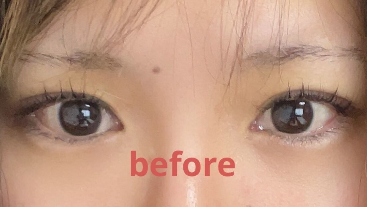 ナチュラルアイテープ/Automatic Beauty/二重まぶた用アイテムを使ったクチコミ（1枚目）