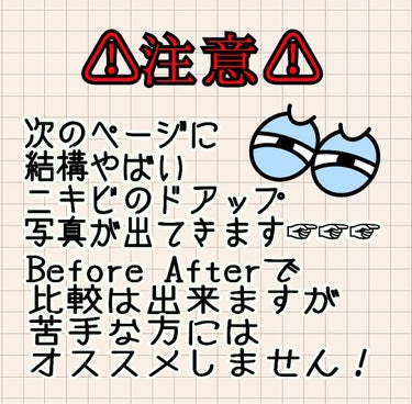 ハトムギ化粧水(ナチュリエ スキンコンディショナー R )/ナチュリエ/化粧水を使ったクチコミ（2枚目）