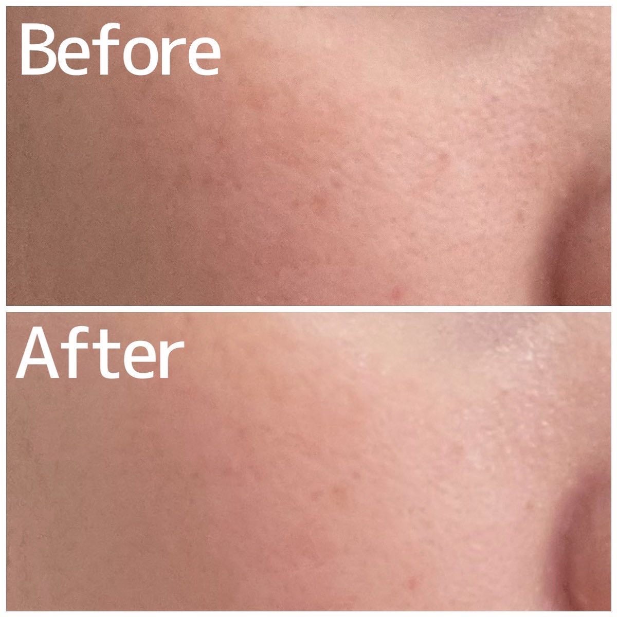 VC ハイドレーティングローション/PLUEST/化粧水を使ったクチコミ(4枚目)