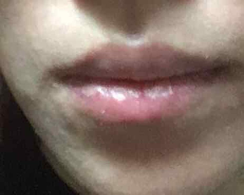 ハニーラスター r/ROAlív/リップグロスを使ったクチコミ（2枚目）